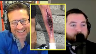 ONLYUSEmeBLADE talk: Updates to his awful leg sores  | PKA