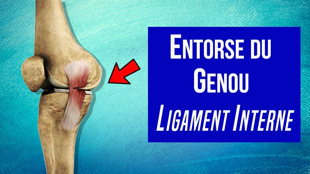 Soigner l'entorse du ligament interne du genou : Les traitements