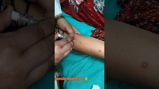 #cannula 22no #trendingshorts #medicalstudent #doctorstrange