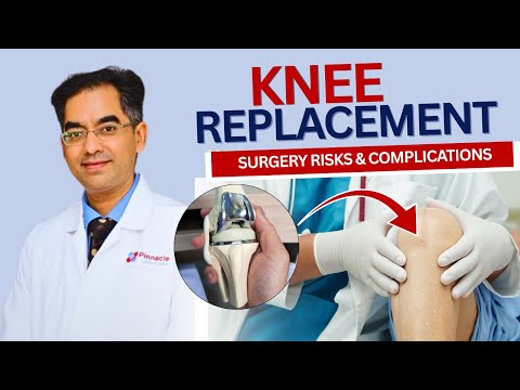 Knee Replacement Surgery Risks & Complications Explained | Dr. Yogesh Vaidya