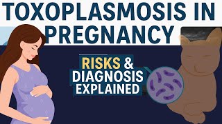 Toxoplasmosis in Pregnancy: Risks, Diagnosis & Ultrasound Signs in 3 MIN!