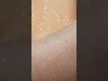 운동 후 수분 손실, 바세린으로 촉촉 보습(러닝편)