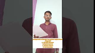 day 3 ... #aiims #aiimsdelhi #nursing #aiimspg