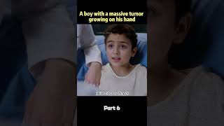 A boy with a massive tumor growing on his hand.