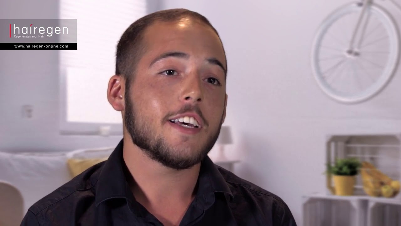 Hairegen Reviews Generate Hair Regrowth Women & men Hair Loss