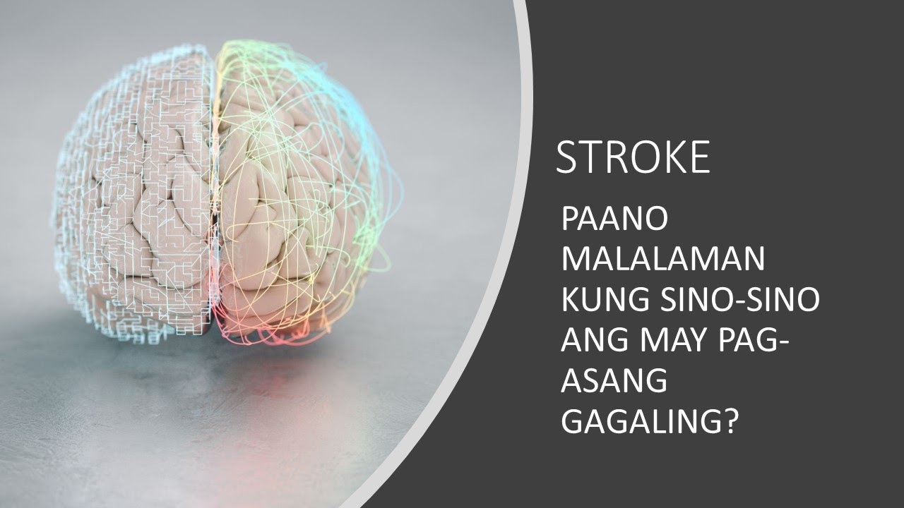 Sino-Sino Ang May Pag-Asang Gumaling Pagkatapos Ma-Stroke?