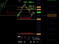  Eternal Limited #EternalLimited #StockMarketIndia #TechnicalAnalysis #PriceAction #SwingTrading