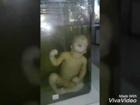 Video: Анатомиялык музей. Дүйнөнүн анатомиялык музейлеринин таң калтырган экспонаттары