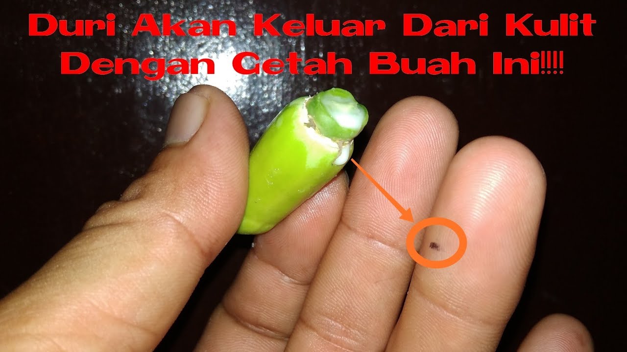 Cara Unik Mengeluarkan Duri Di Kulit Tangan Atau Kaki Dengan