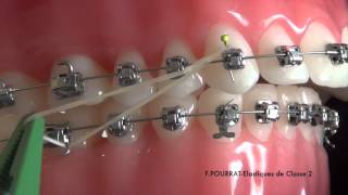 Acheter Élastiques de Correction des dents de qualité médicale, bandes de caoutchouc  dentaires, anneaux en Latex, anneaux orthodontiques