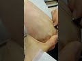 Intramuscular Injection Safely | Nurse-Level || IM Injection Step-by-Step Training Guide Class 13