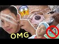 I Had Lasik Eye Surgery! 😱 *Graphic Content*