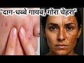 How to Remove Black Layer from Face/चेहरे की कालीपरत जड़ से साफ+मुल्तानी मिट्टी से गोरीस्किन पाएं 😍