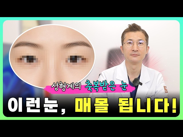 👀 이런 눈은 ‘매몰법’ 해도 잘 안 풀립니다