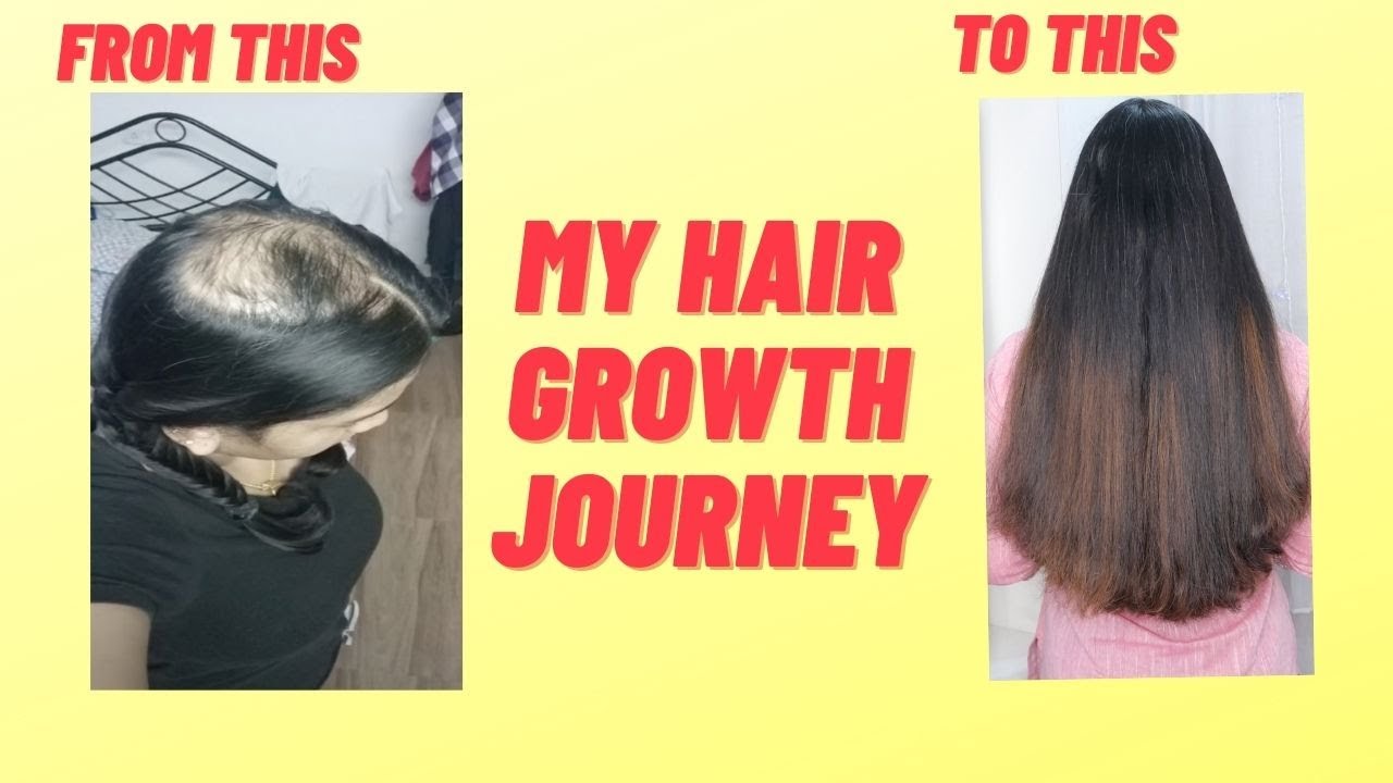 My Hair Growth Journey - YouTube