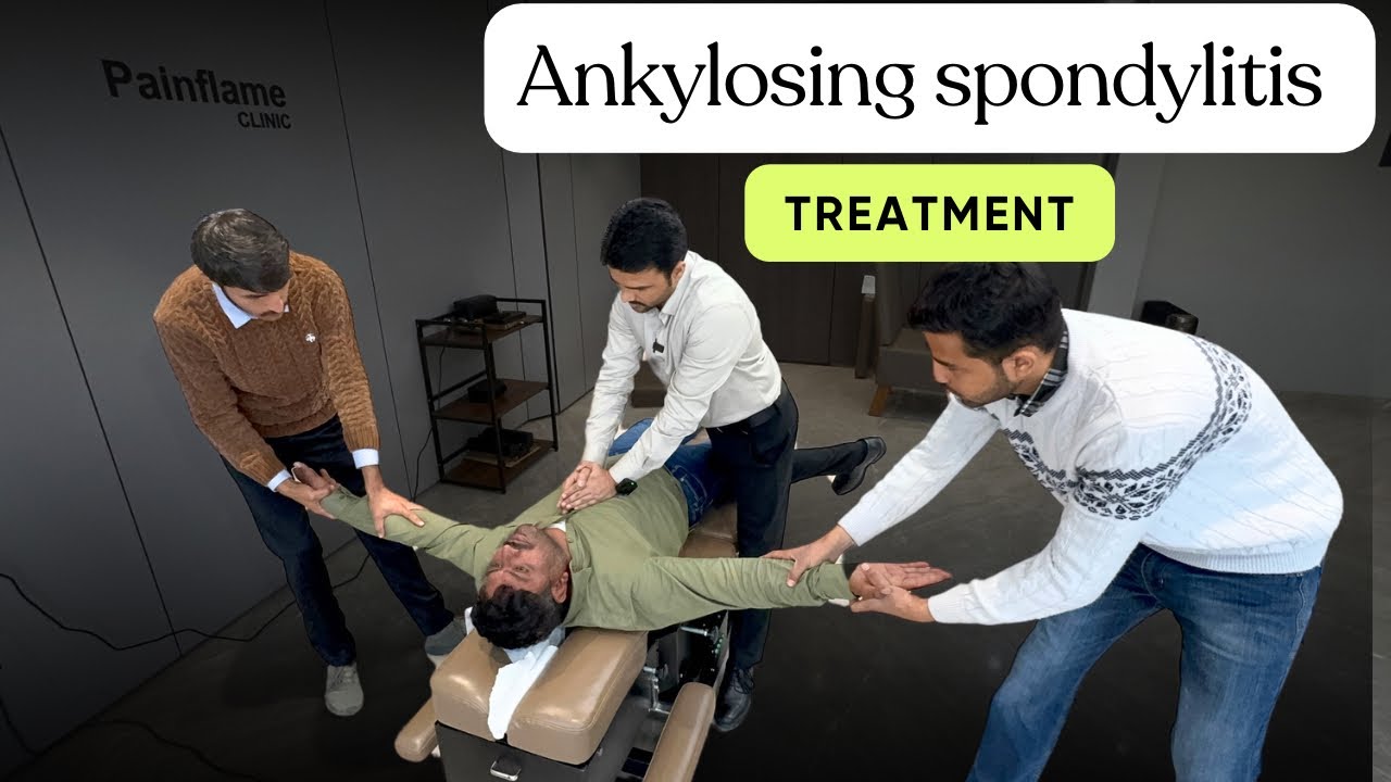 Want FAST Relief From Ankylosing Spondylitis? Watch This Now