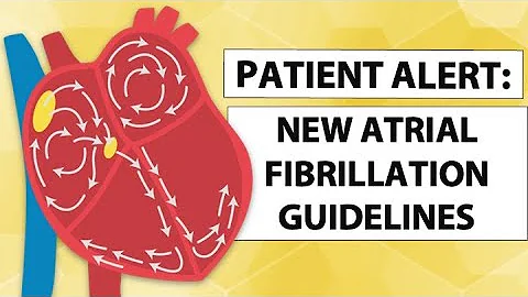 Patient Alert! New Atrial Fibrillation Treatment Guidelines to Prevent Stroke!