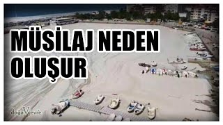 Deni̇z Salyasi Müsi̇laj Nedi̇r ? Nasil Oluşur ? Nasil Temi̇zleni̇r ?