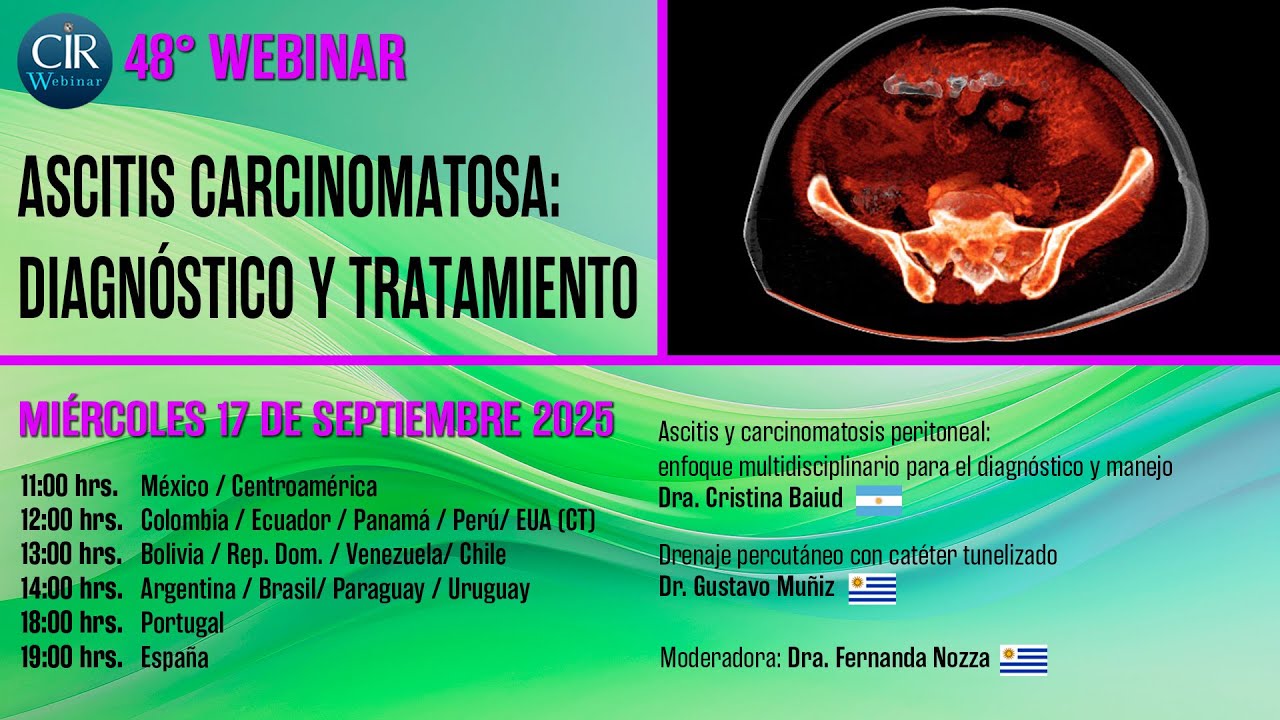 Ascitis carcinomatosa: diagnóstico y tratamiento - 48o Webinar