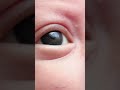 5 Incredible facts about our EYES 👁️✨#youtubeshorts #health
