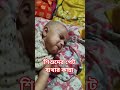 শিশুদের পেট ব্যথার কান্না। Abdominal pain।Children।