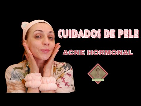 ASMR Portugal: Cuidando da minha pele com ACNE HORMONAL
