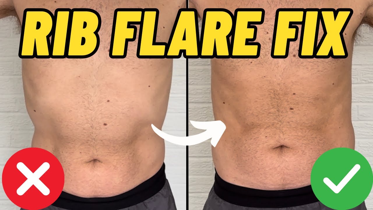 How I FIXED My Rib Flare FOR GOOD! (3 Easy Exercises) 
