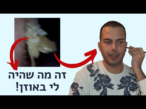 וִידֵאוֹ: כיצד להסיר 