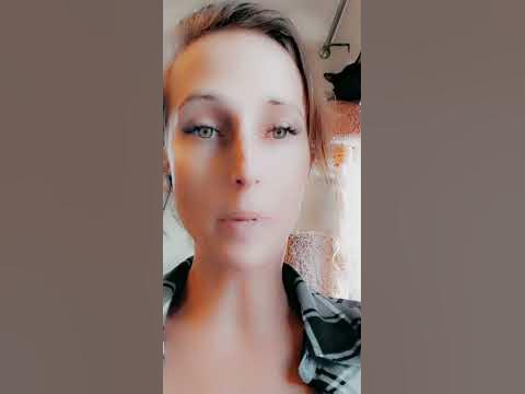 Female Pectus Excavatum - update - YouTube