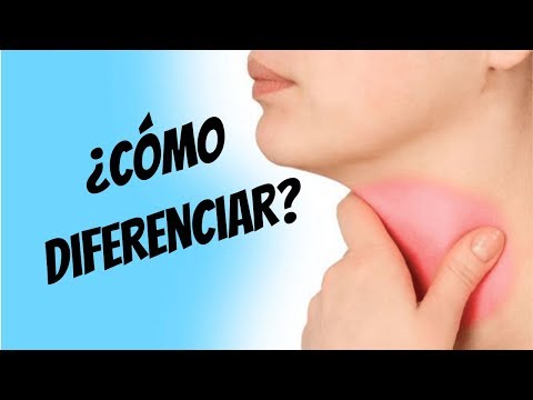 Vídeo: Dolor De Garganta Y Alergias: Cómo Se Relacionan, Tratamiento Y Más