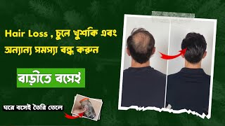 চুল পড়া এবং খুশকি বন্ধ করুন সহজেই stophairfall চুল পড়া বন্ধের উপায়