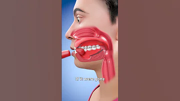 If You Lost Your Tongue 