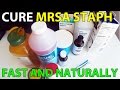 Cure MRSA Staph Infection Fast Natural Treatment