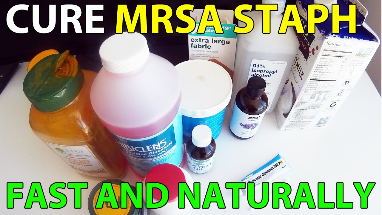 Cure Mrsa Staph Infection Fast Natural Treatment