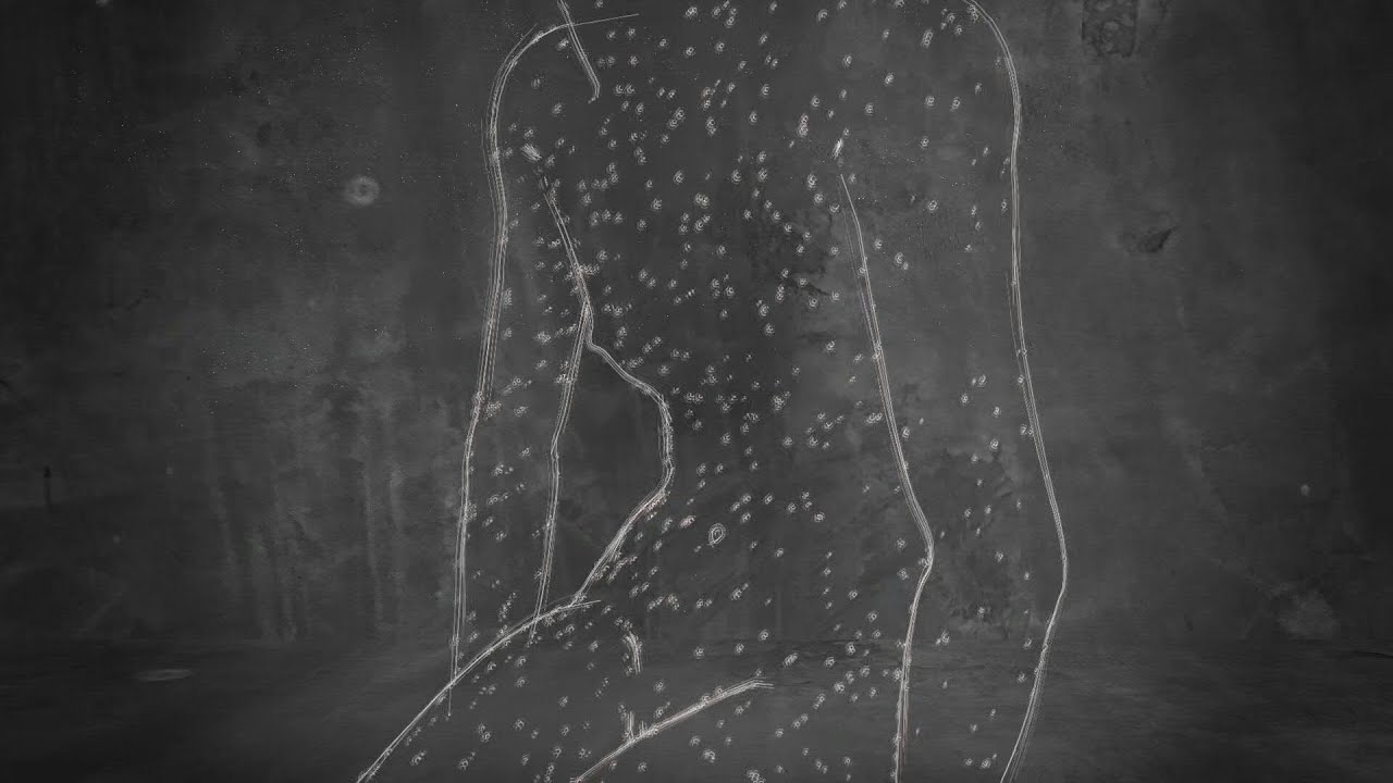Monkeypox |  AFP