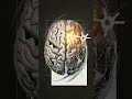 Why Rejection Feels Like Getting Hurt #heartbreak #science #brain