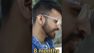 minoxidil 10 month beard journey amazing results minoxidil 10months beardgrowthoil tugainshorts