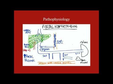 Portal Hypertension - CRASH! Medical Review Series