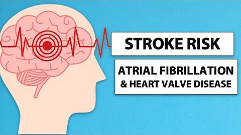 Stroke Risk Reduction for Atrial Fibrillation & Heart Valve Patients