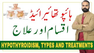 Hypothyroidism - Types and Treatments in Urdu/Hindi