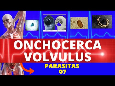 Vídeo: Eliminação Da Oncocercose Da Colômbia: Primeira Prova Do Conceito De Eliminação Da Oncocercose No Mundo