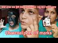 charcoal peel off marks🥰যারা প্রথম বার ট্রাই করবে এই ভিডিও শুধু মাত্র তাদের জন্য,ব্যবহার করলে কি হবে
