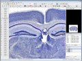 Webinar stereological techniques for area and volume estimation