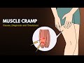 Muscle cramp, Causes, Signs and Symptoms, Diagnosis and Treatment.