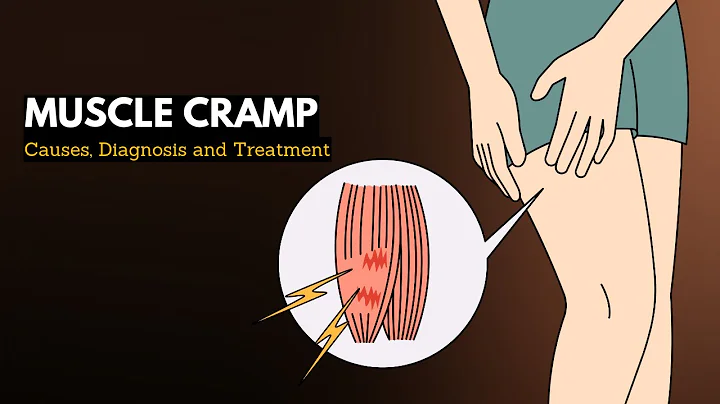 Muscle cramp, Causes, Signs and Symptoms, Diagnosis and Treatment. - DayDayNews