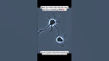 This is how your brain cells act when you learn something new #shorts #neuroscience #neuroplasticity