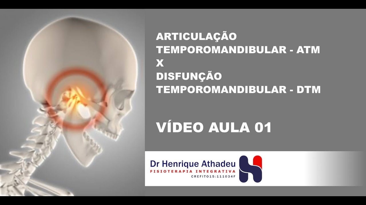 Disfunção da articulação temporomandibular (ATM).