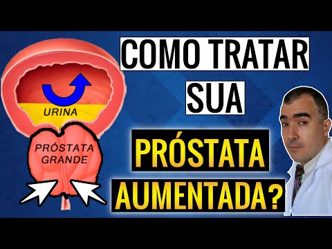 Vídeo: 3 maneiras de tratar uma próstata aumentada