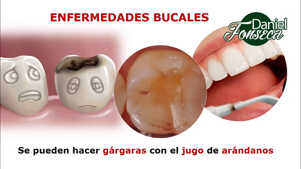 Butycaps para que sirve