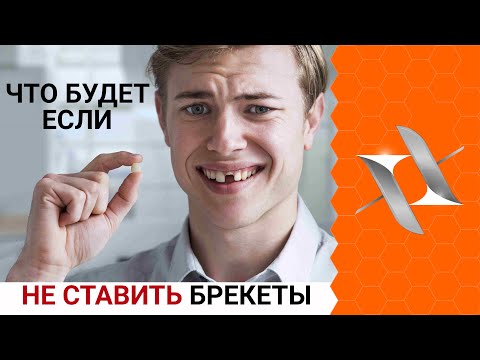 Что будет если НЕ СТАВИТЬ БРЕКЕТЫ? | 8  факторов риска